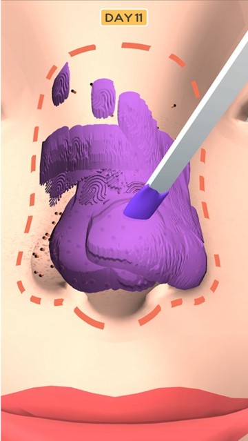 鼻子美容师小游戏截图